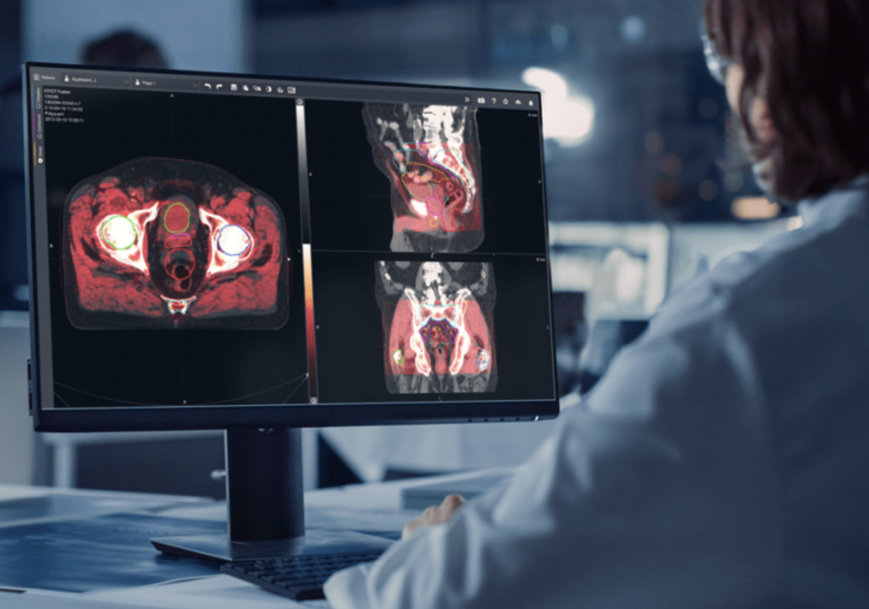GE HEALTHCARE’S MIM SOFTWARE COLLABORATES WITH ELEKTA